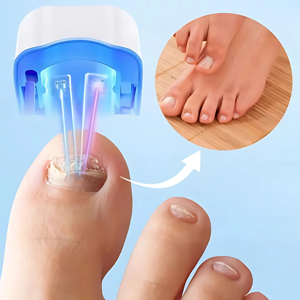 Laser Nail Fungus Care Device
