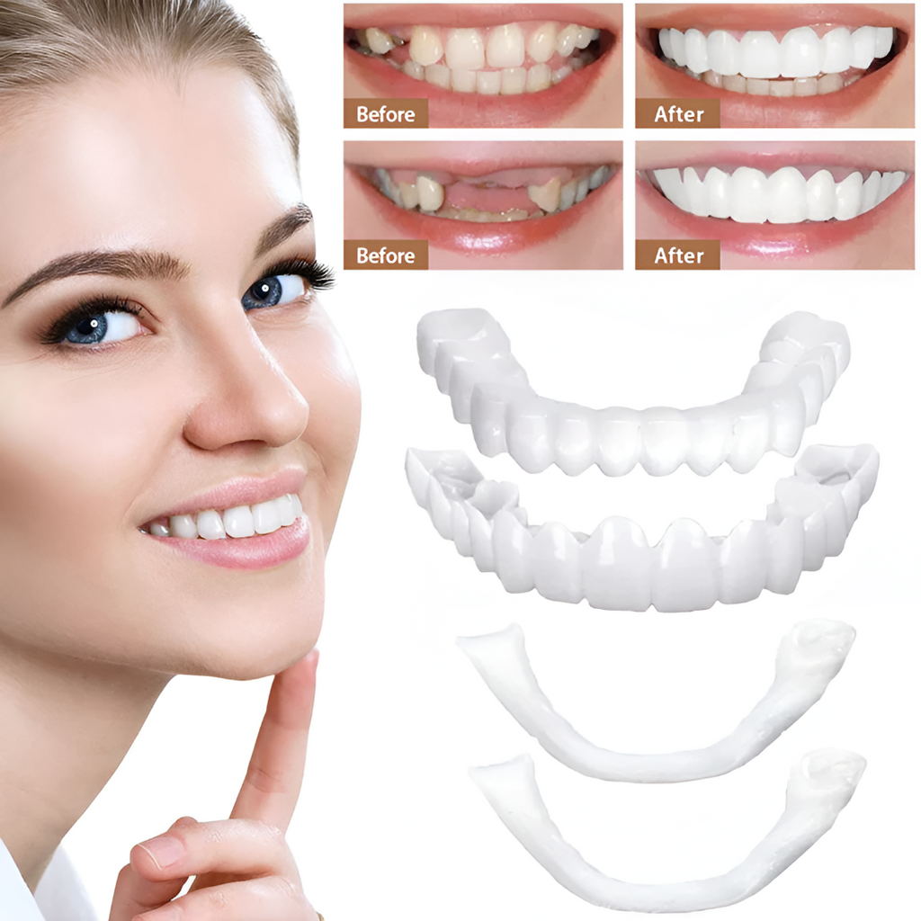 Snap-On Cosmetic Tooth Veneers for Instant Smile Cover