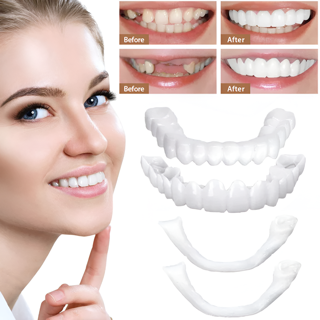 Snap-On Cosmetic Tooth Veneers for Instant Smile Cover