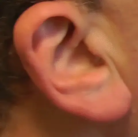 Rechargeable invisible hearing aids with clear sound